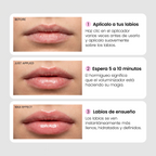 Voluminizador de labios